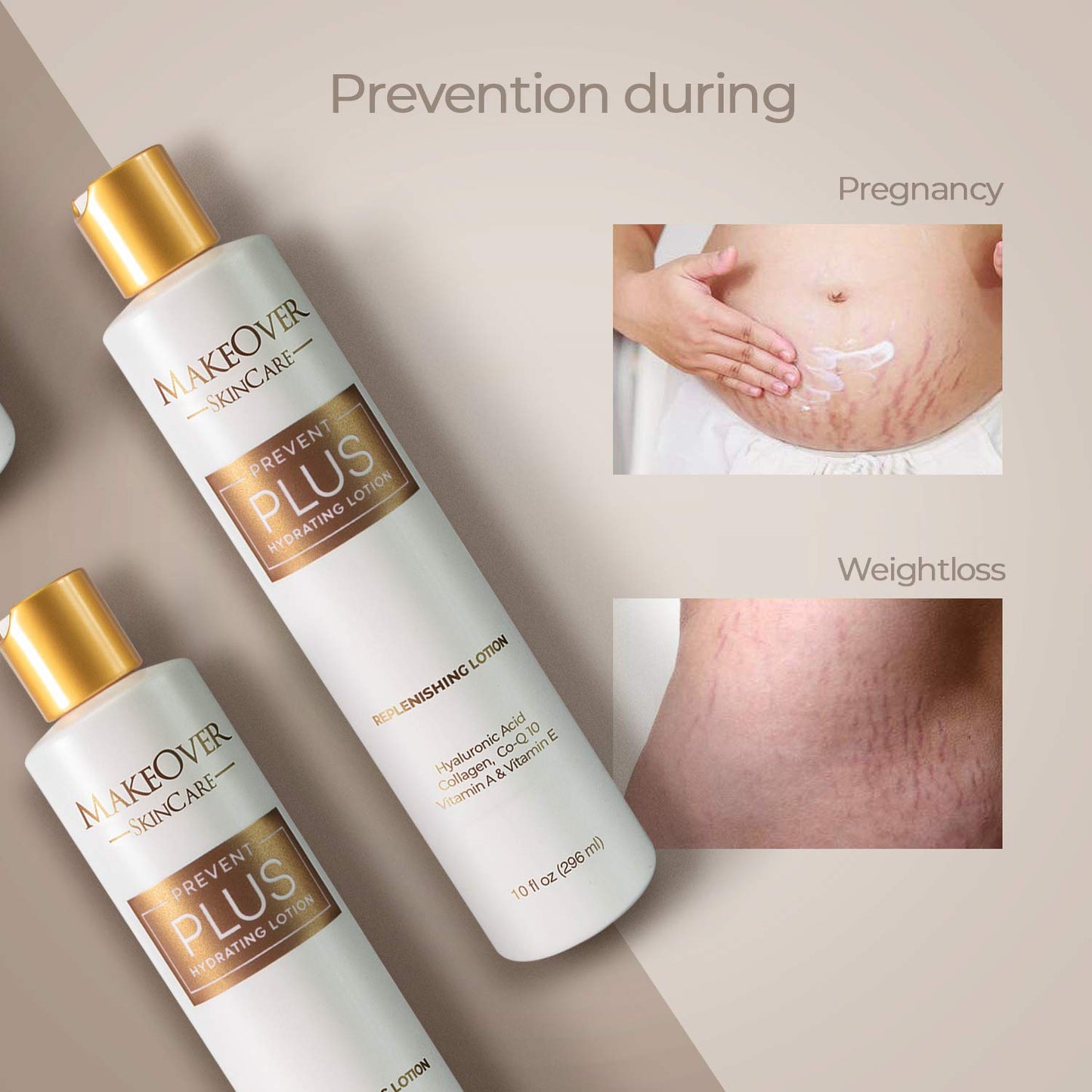 Prevent Plus Hydrating Lotion, Stretch Mark & Scar Care, 1oz